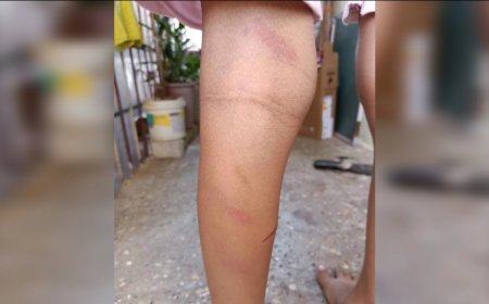 दुसरीत शिकणाऱ्या विद्यार्थ्याला स्पेलिंग आली नाही,शिक्षिकेने अमानुष मारहाण केली,दाखल झाला गुन्हा