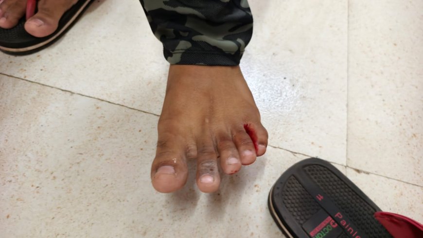 बिग ब्रेकिंग | इंदापुरात दहाहून अधिक नागरिकांना पिसाळलेल्या कुत्र्याने घेतला चावा